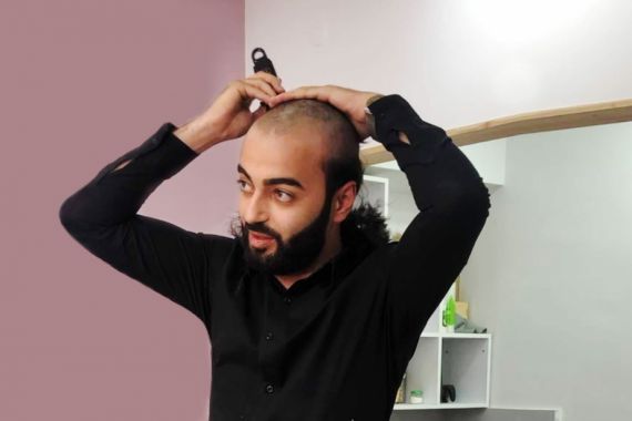 Հայկ Հովհաննիսյանը՝ գլուխը սափրելու պատճառի մասին