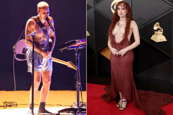 &laquo;Գրեմմի 2026&raquo;-ի ինտրիգները. շփոթված Շերը, վարտիքով Բիբերը եւ կիսամերկ Ռոուն 